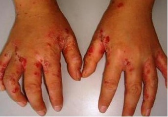 �Խ괯������Ƶķ���