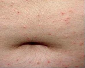 �����ν괯