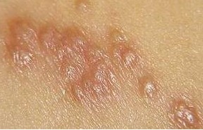 �괯������֢״