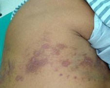 ��״����ĳ���֢״