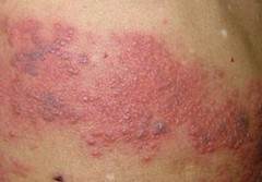 ��״�������֢����Щ