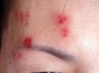 ��״����Σ��֮�۲���״����