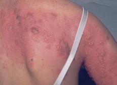 ��״�����ʲôҩ