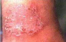 ÌåÑ¢µÄÕï¶Ï¼ø±ð