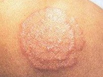 ������Ѣ��֢״����Щ����