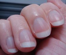 Ů�Ի���ָ�׵�ԭ��