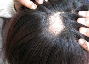 �������ѷ���ԭ��