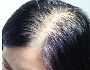 ֬�����ѷ�