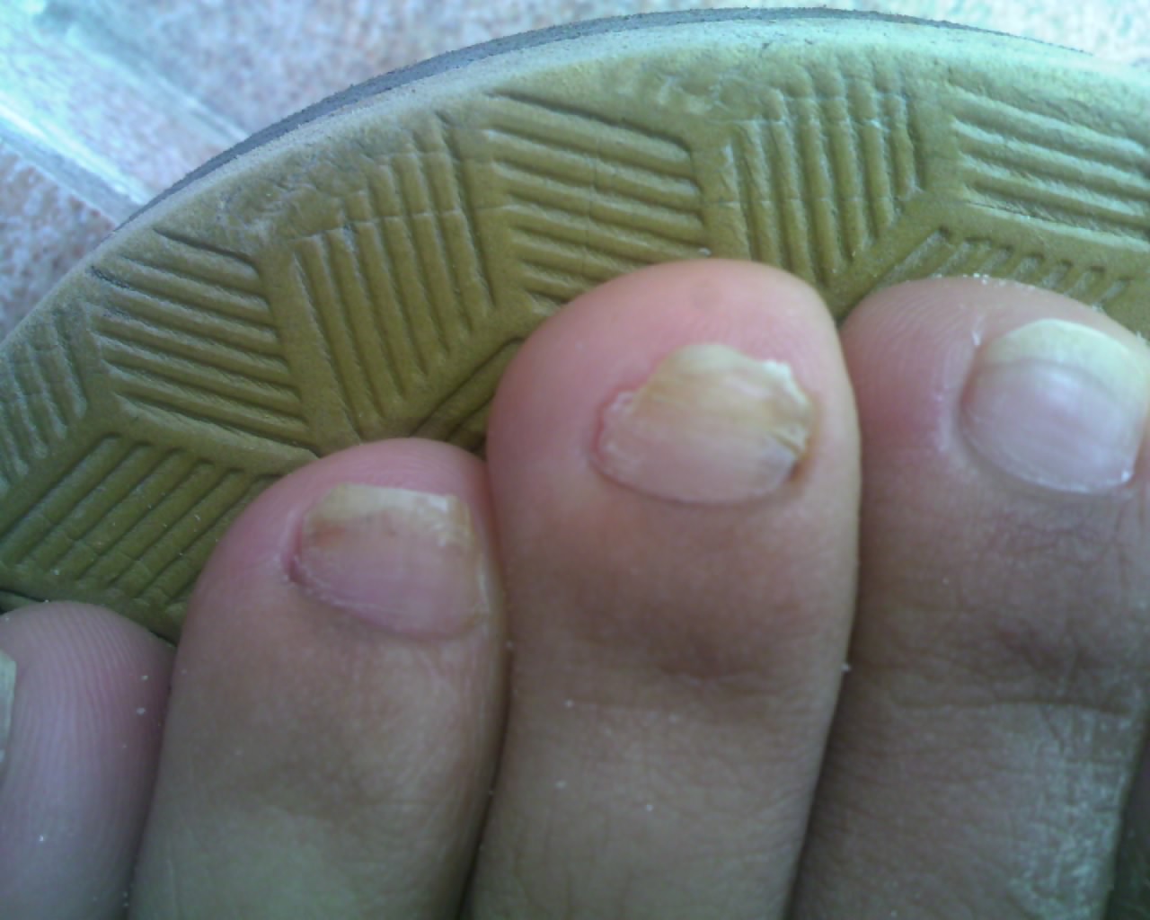 ������ָ�׵�����֢״