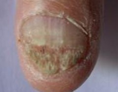 ��ָ����ô����Ч����