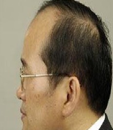 ֬�����ѷ�֢״