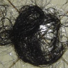 ץ�ҽ���֬�����ѷ���֢״