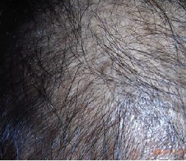 ���������ѷ�������