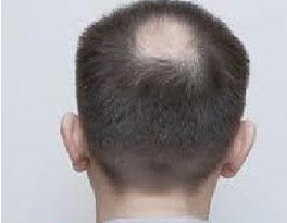 �ѷ���ͺ���Ʒ�����ʲô