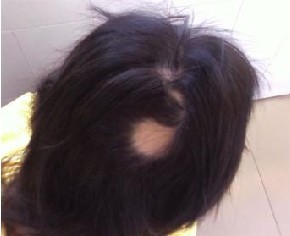 ֬�����ѷ��Ͱ�ͺ�ļ���Ƚ�