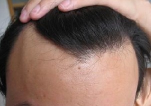 �ѷ���ԭ��