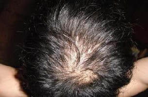 ���������ѷ��ĳ�������