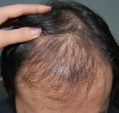 ֬�����ѷ�������