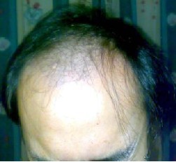 ���ư�ͺע����ص�