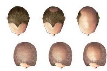 �ѷ�������