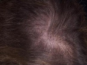 �ѷ���ԭ��