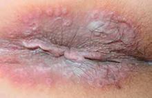 ����ʪ��Ĳ�����ʲô