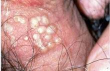 ��ֳ�������Σ��