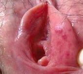 ��ֳ���������Ů�Ե�Σ��