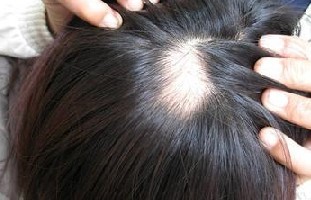 �ϲ��ļ�ҽԺ�����ѷ���