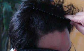 �ϲ��ѷ�������Ҫ��Щ�����