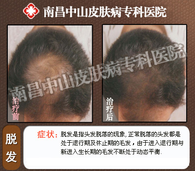 �ϲ������ѷ���Ȩ����ҽԺ