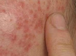 Ƥ������ץ����С������ô��