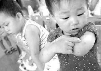 Ƥ��������ʲôԭ��