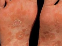 ÷�����������ʲôΣ��