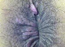 ��η�ֹȾ��÷��