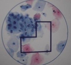 �ܲ�����ԭ����ʲô