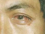 �ܲ��Խ�Ĥ�׵�����