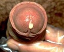 �ܲ������Ԥ������