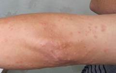 �ϲ��ļ�ҽԺ��ţƤѢ��