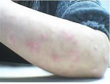 �ϲ�������ţƤѢ��