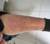 �ϲ��ļ�ţƤѢҽԺרҵ