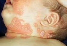 �ϲ�ƤѢ���ļ�ҽԺ��