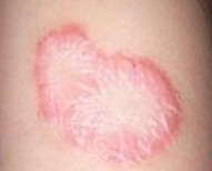 �ϲ��ļ�ţƤѢҽԺ��