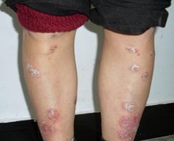 �ϲ�����ţƤѢҽԺ�ļ����