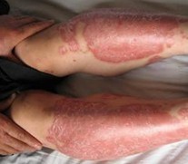 �ϲ�����ţƤѢ�ļ�ҽԺ��