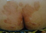 �ϲ�����ţƤѢҽԺ