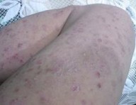 �ϲ��ȽϺõ�ţƤѢҽԺ