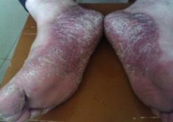 �ϲ���ţƤѢ��õ�ҽԺ