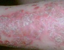 �ϲ��ļ�ţƤѢҽԺ����