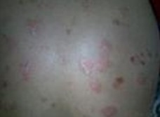 �ϲ�ҽԺţƤѢҽԺ�ļ����